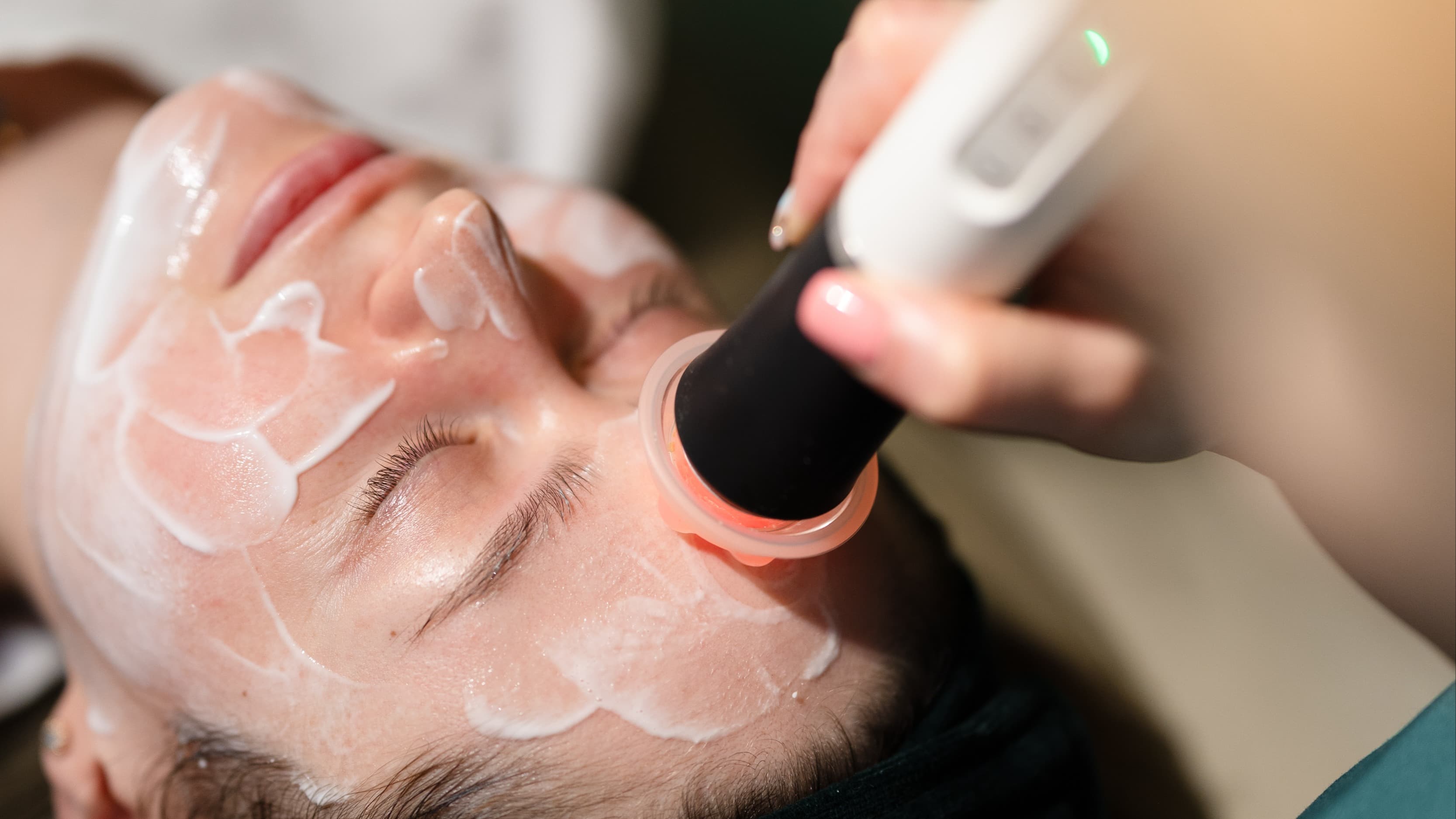 w trakcie zabiegu geneo w krakowie