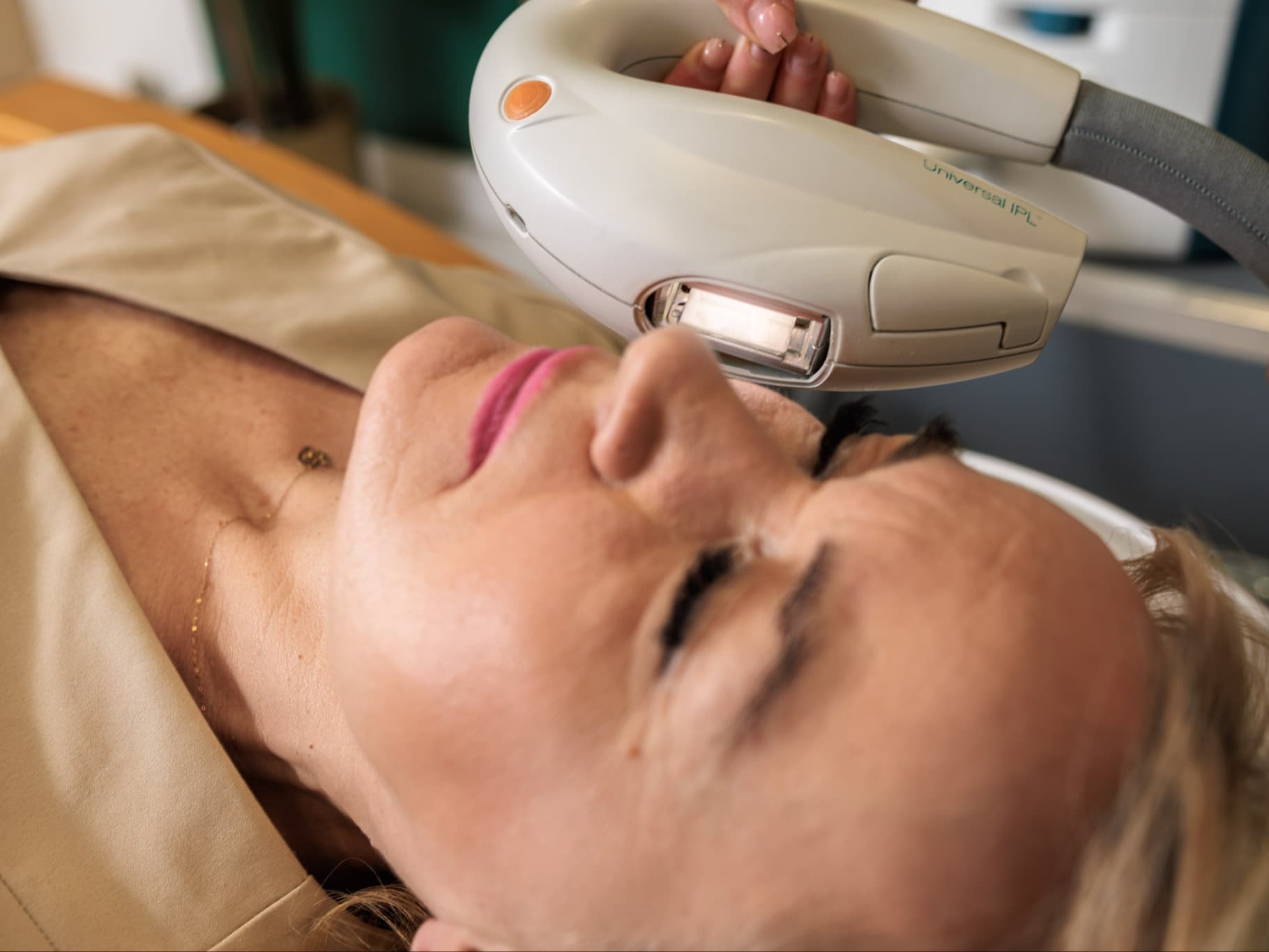 w trakcie laserowego zamykania naczynek na twarzy w salonie kosmetycznym w krakowie