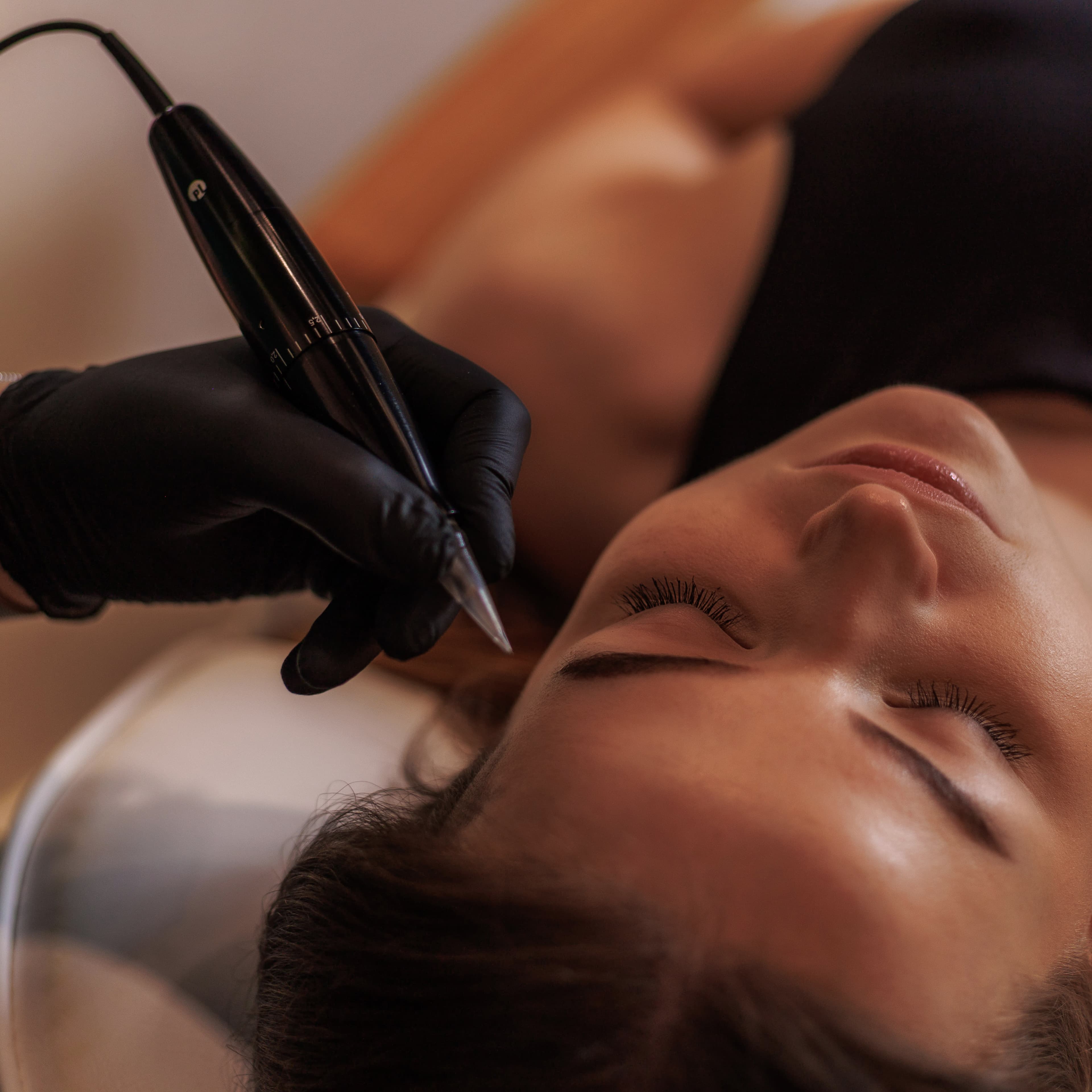 mikropunktura scarink w krakowie