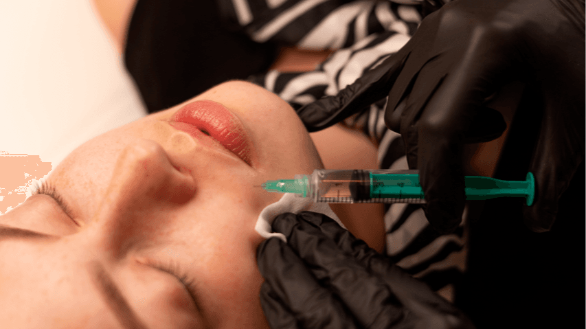 wolumetria twarzy kwasem hialuronowym