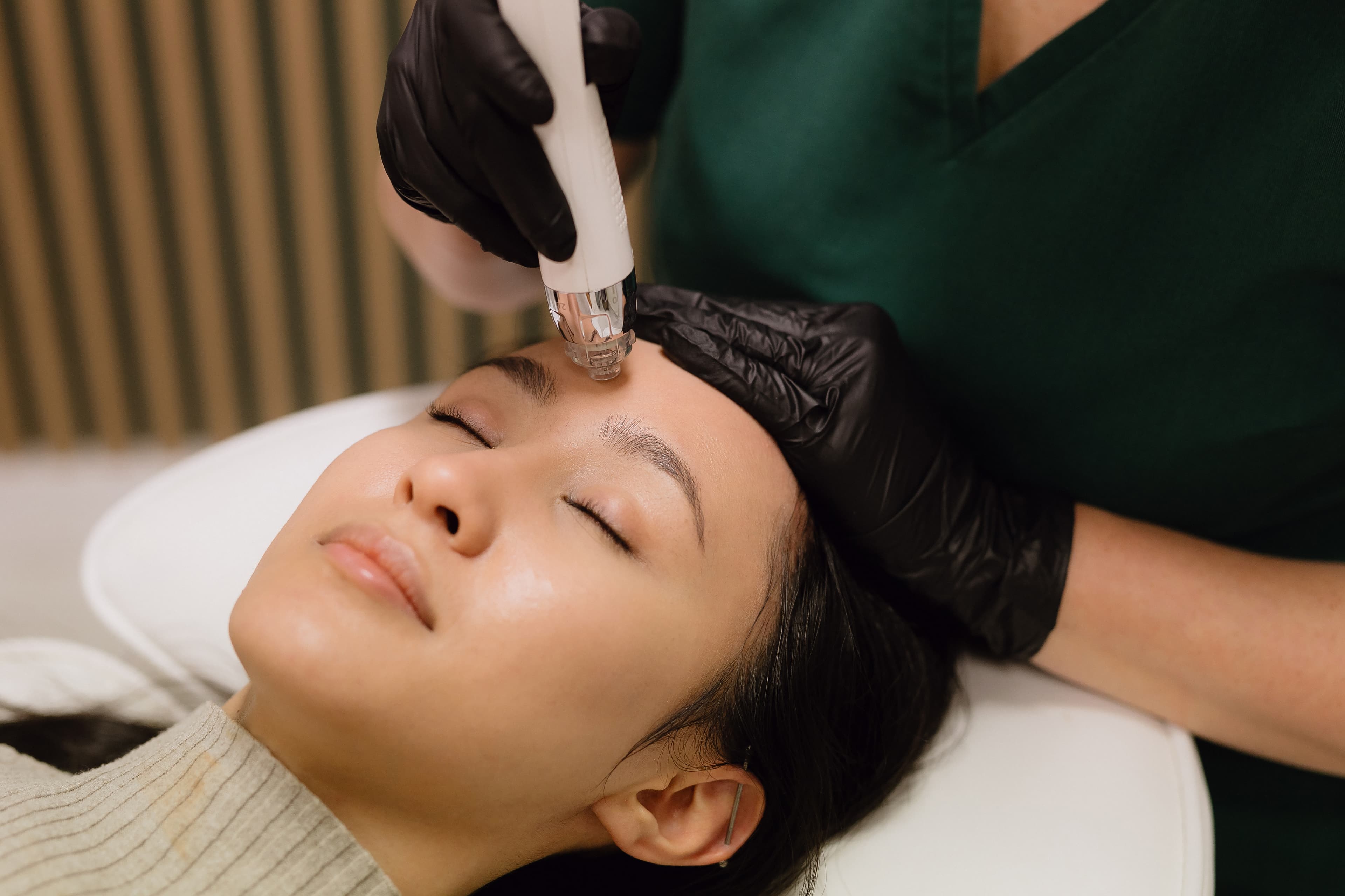 zbliżenie w trakcie zabiegu mezoterapia mikroigłowa dermapen EPN w salonie kosmetycznym Health and beauty w Krakowie