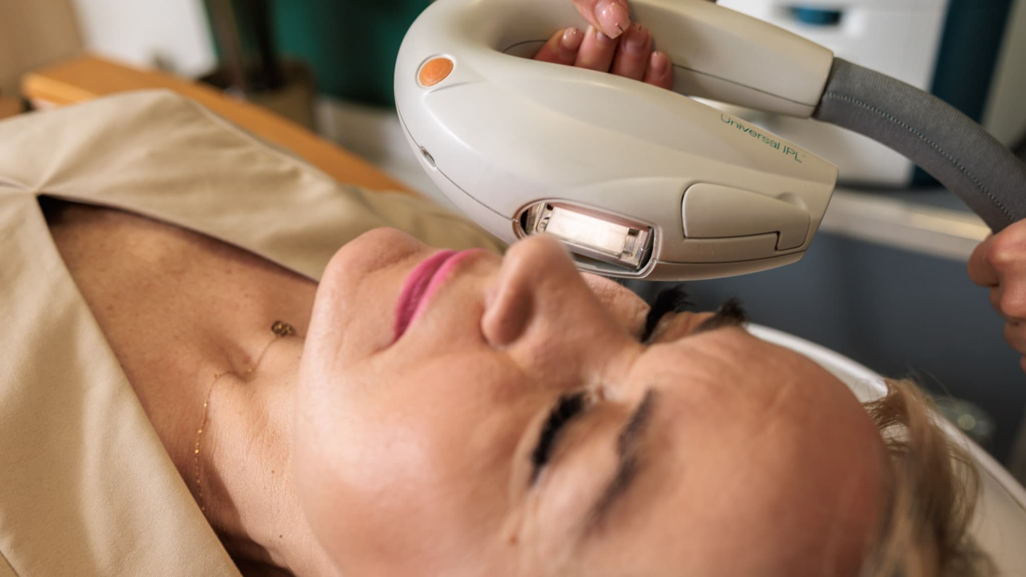 w trakcie laserowego zamykania naczynek na twarzy w salonie kosmetycznym w krakowie