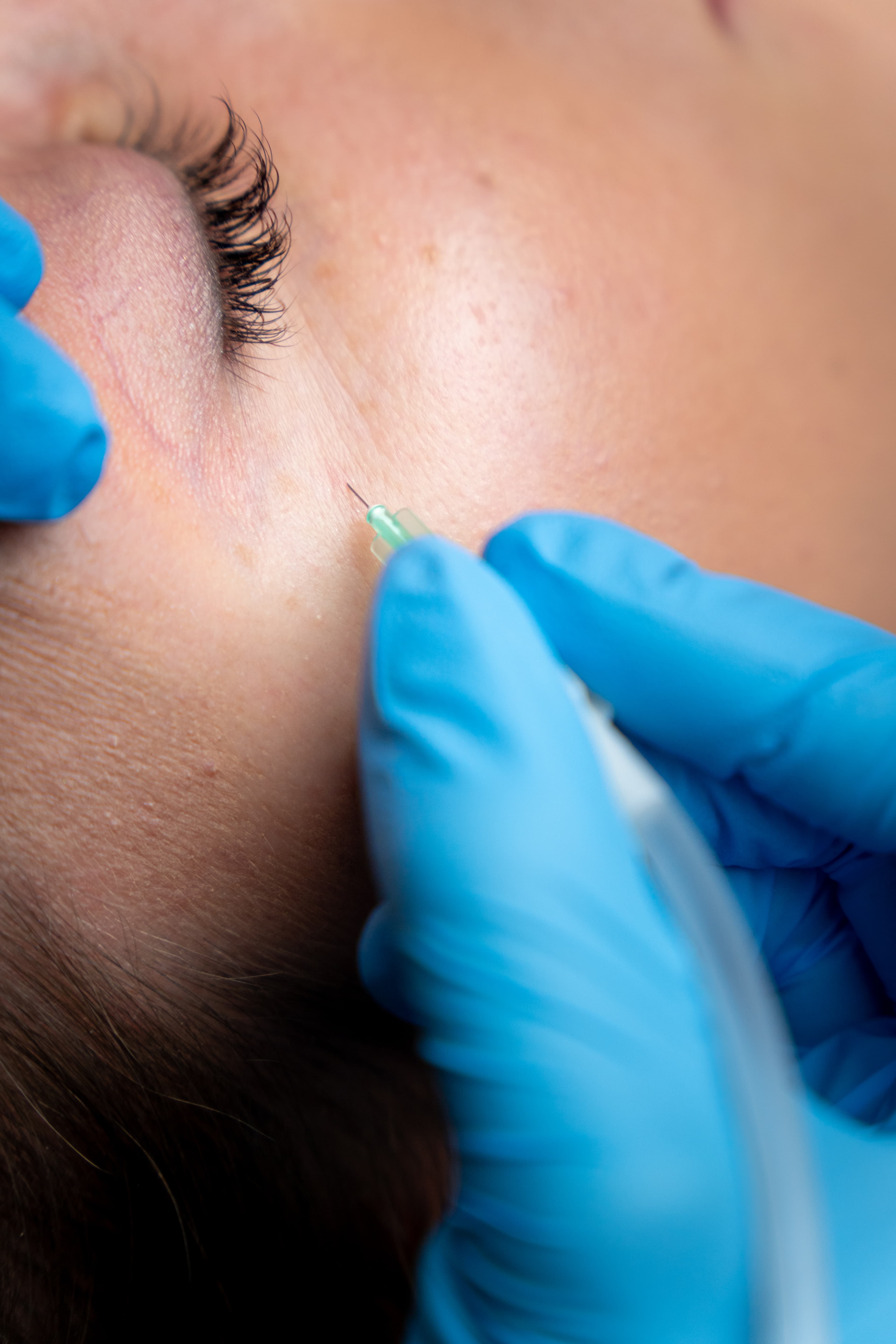 katboksyterapia na twarzy