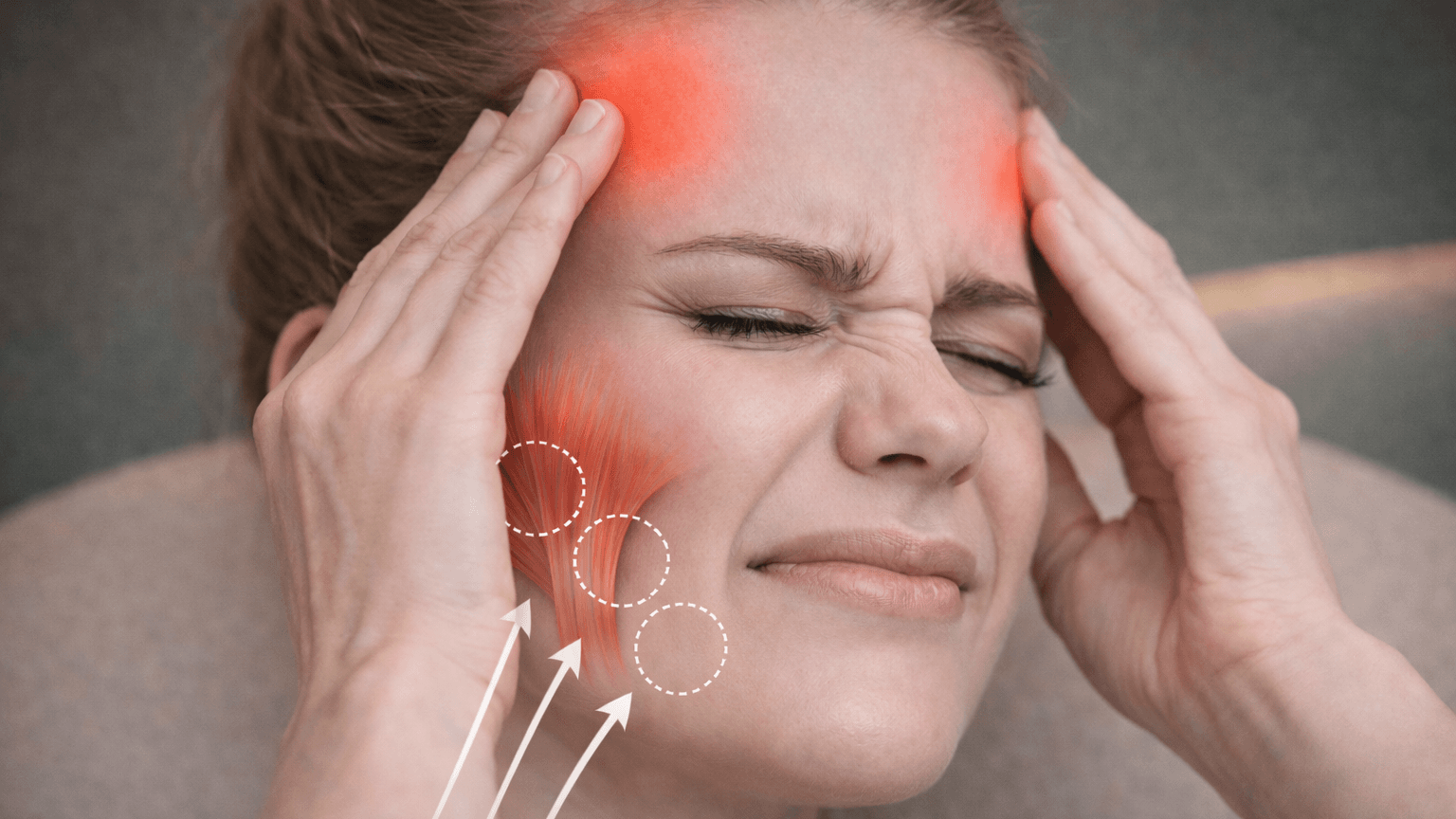 toksyna botulinowa na bruksizm