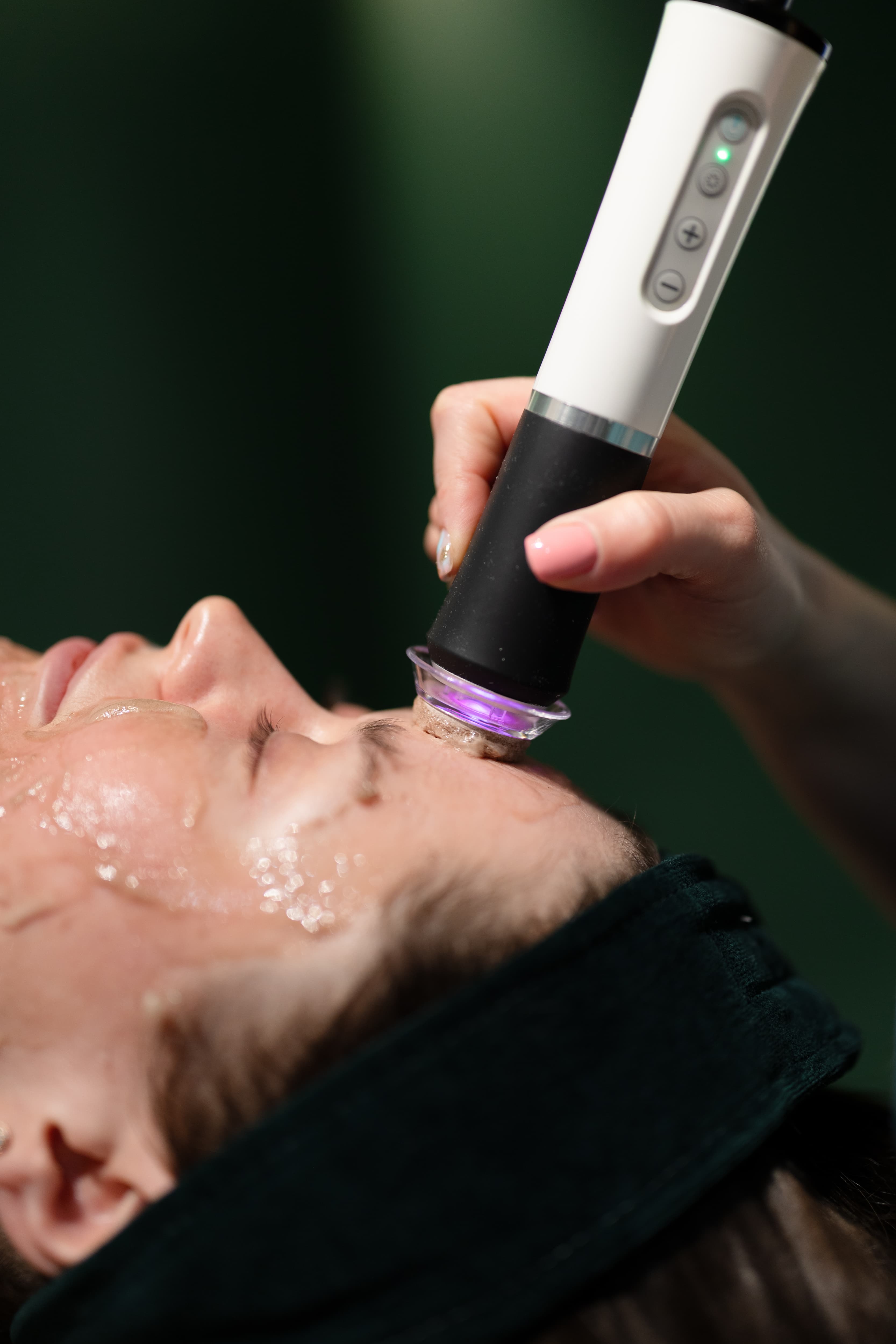 zabieg geneo w krakowie