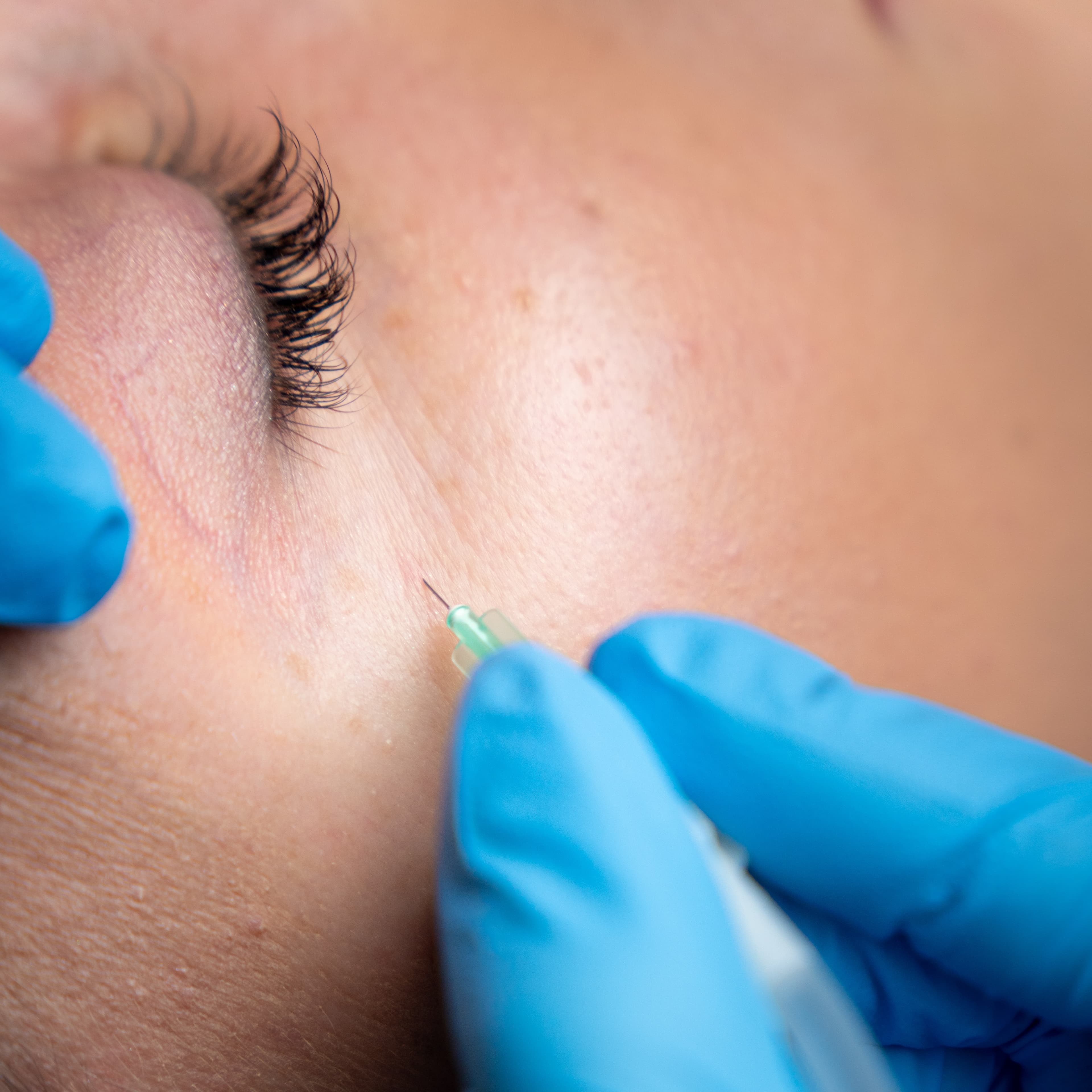 katboksyterapia na twarzy